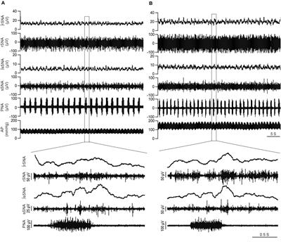 Augmented Respiratory–Sympathetic Coupling and Hemodynamic Response to Acute Mild Hypoxia in Female Rodents With Chronic Kidney Disease